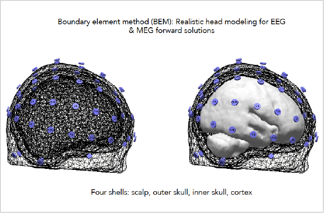 slide15_BEM_brain