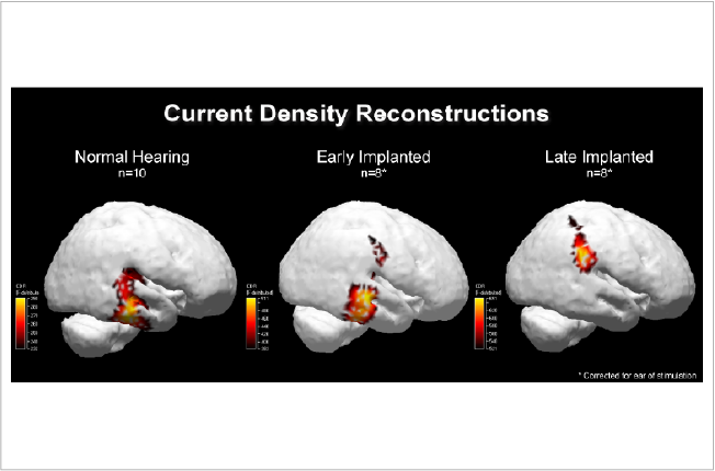 slide10_Implant_CDR